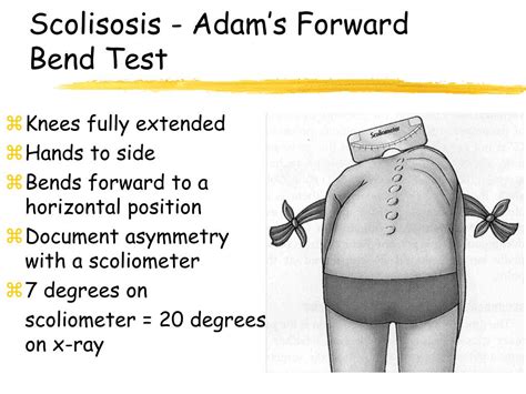 adams and cobbs test|adams test for scoliosis.